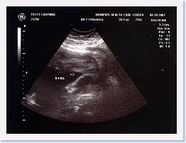September - Sara Ultrasound - * 1086 x 819 * (1.12MB)